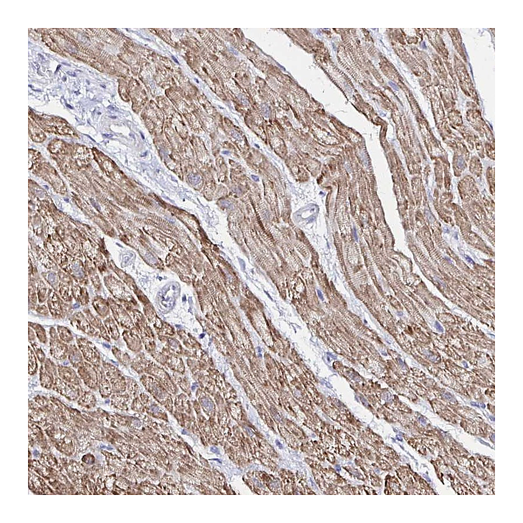 Atlas Antibodies Anti-RHOBTB2 Antibody