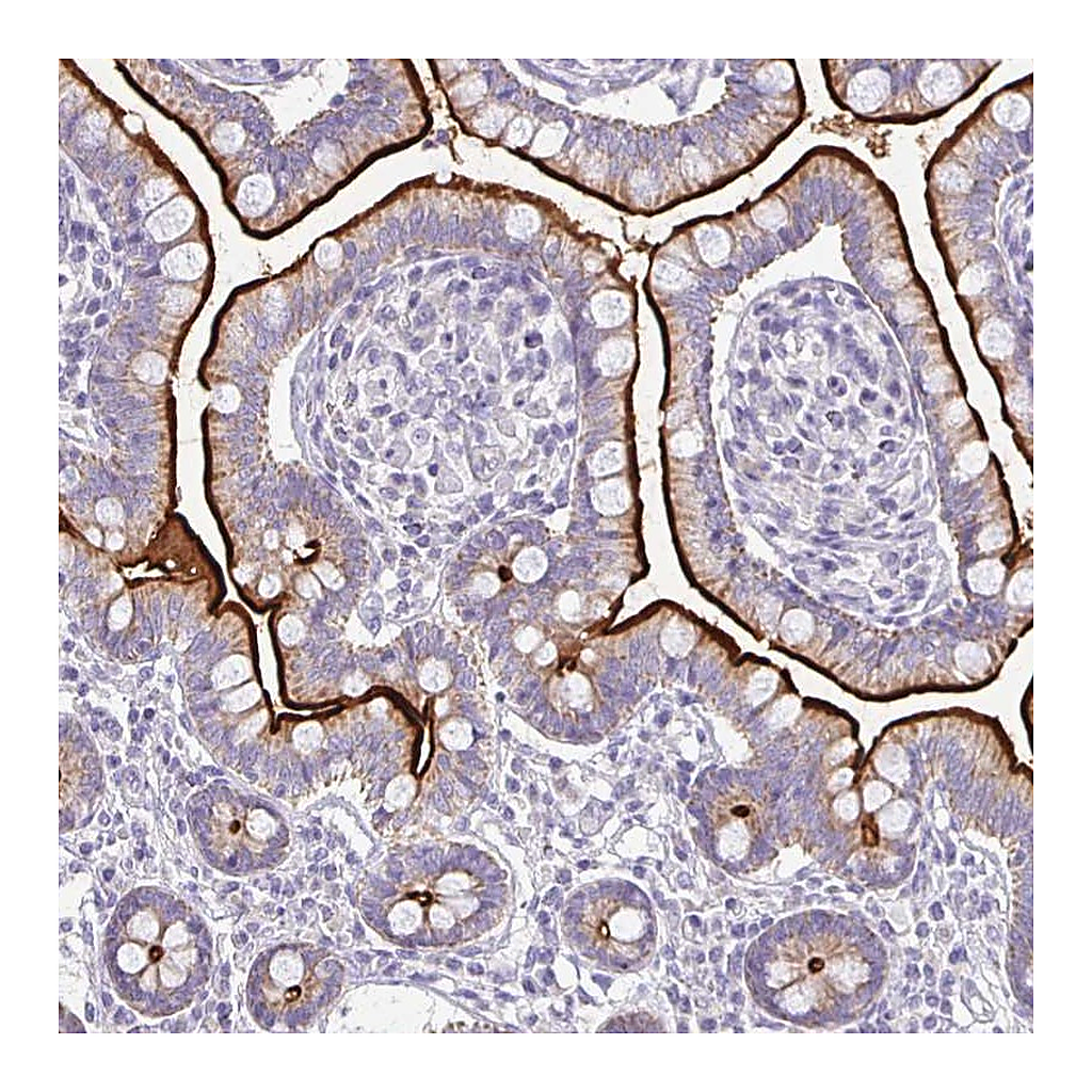 Atlas Antibodies Anti-RHOC Antibody