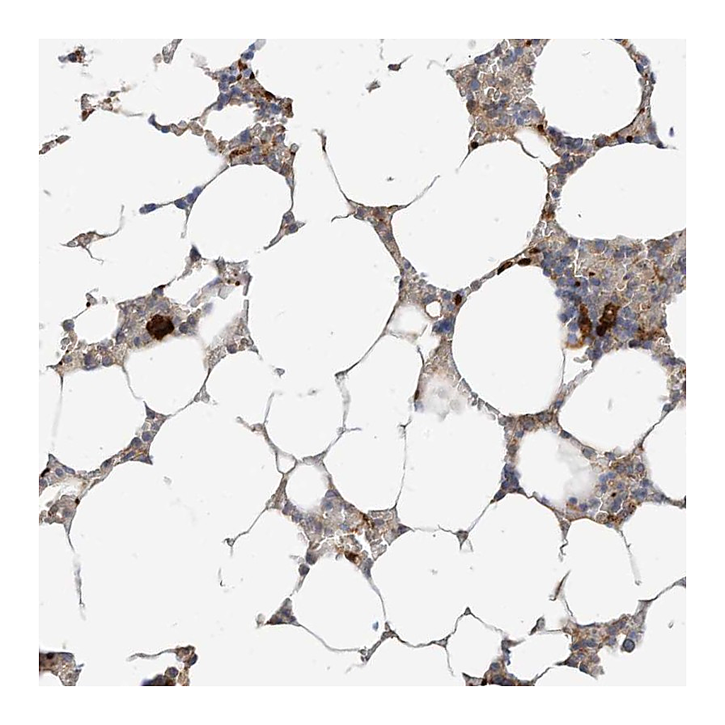 Atlas Antibodies Anti-RHOH Antibody