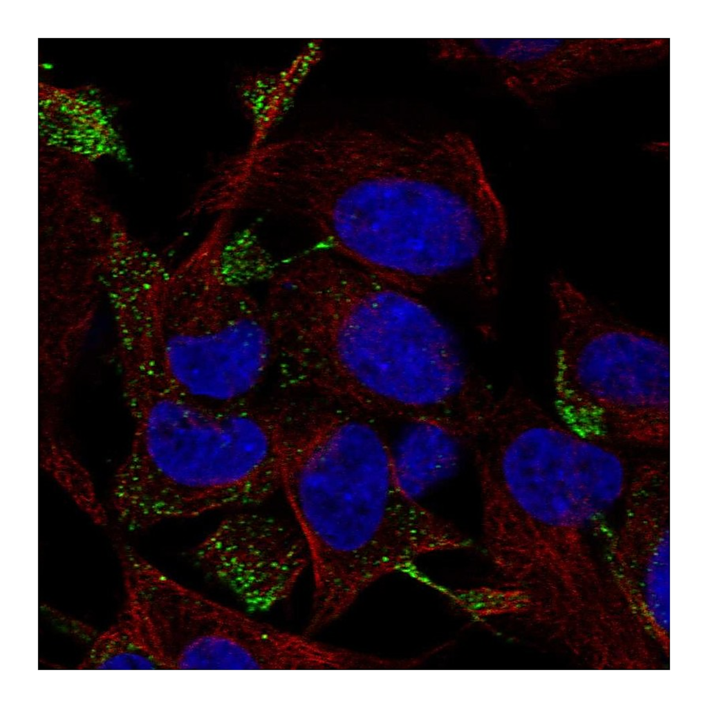 Atlas Antibodies Anti-RHOQ Antibody