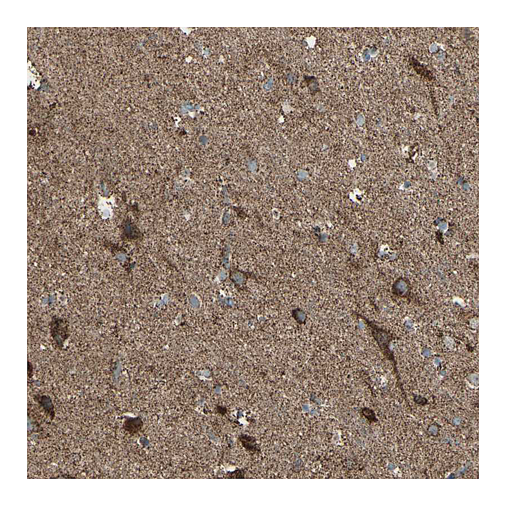Atlas Antibodies Anti-RHOT1 Antibody