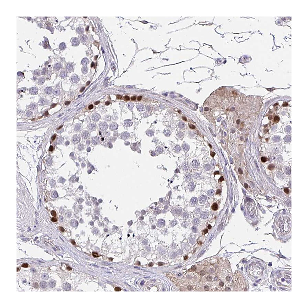 Atlas Antibodies Anti-RHOXF1 Antibody