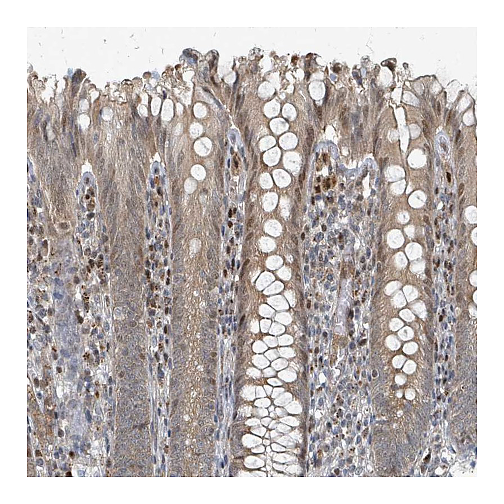 Atlas Antibodies Anti-RHPN2 Antibody