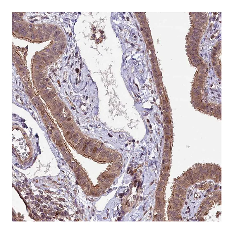 Atlas Antibodies Anti-RIC8A Antibody