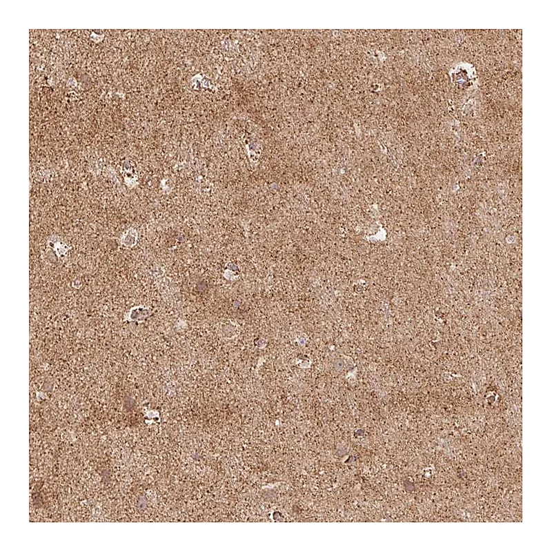 Atlas Antibodies Anti-RIC3 Antibody