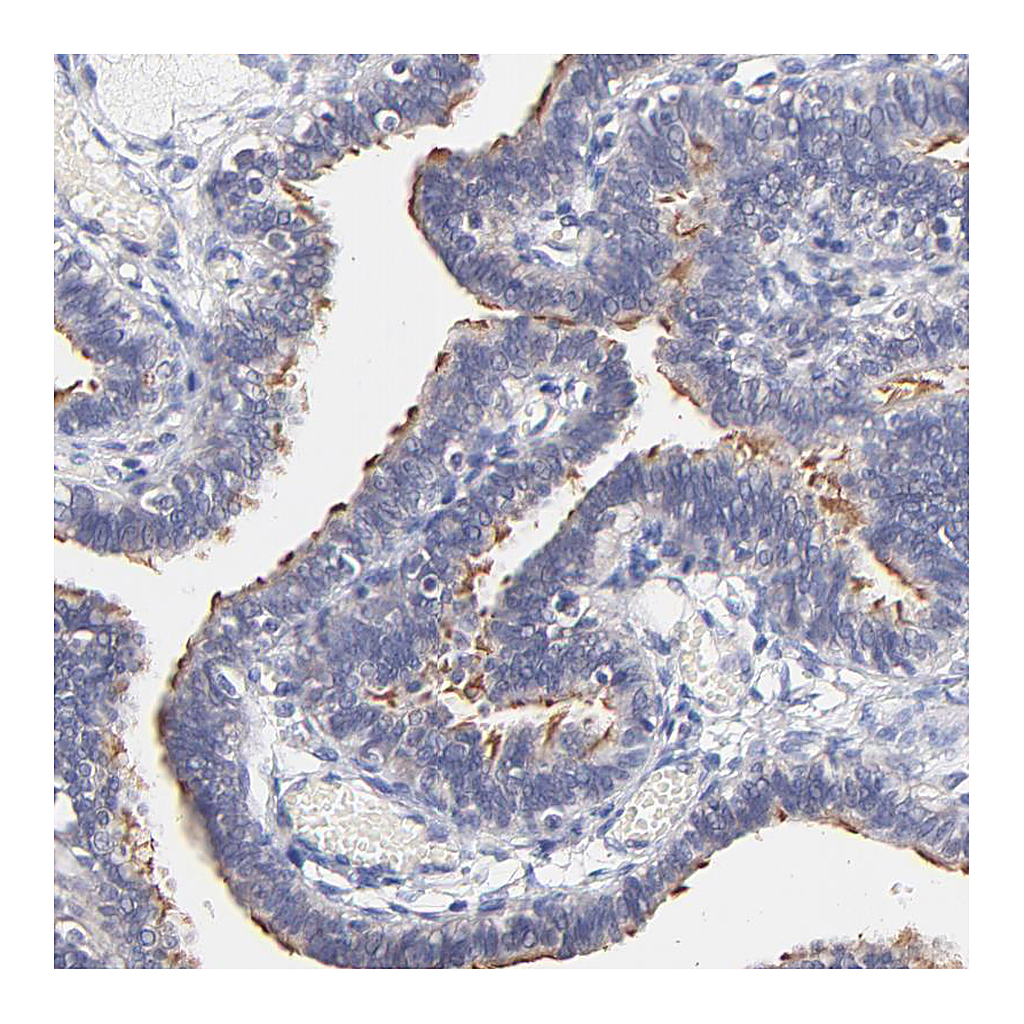 Atlas Antibodies Anti-RIBC2 Antibody