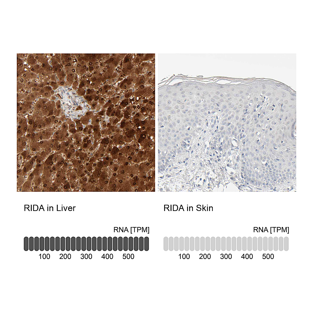 Atlas Antibodies Anti-RIDA Antibody