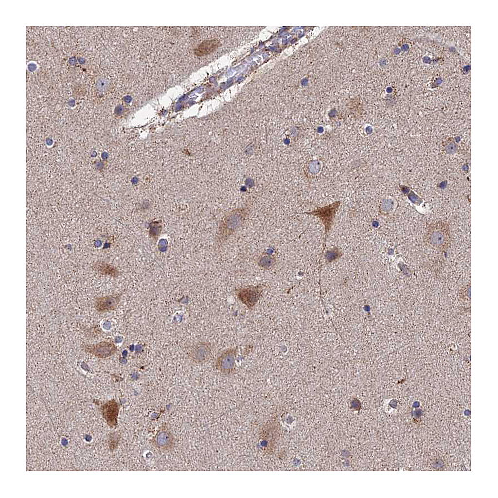 Atlas Antibodies Anti-RIC8B Antibody
