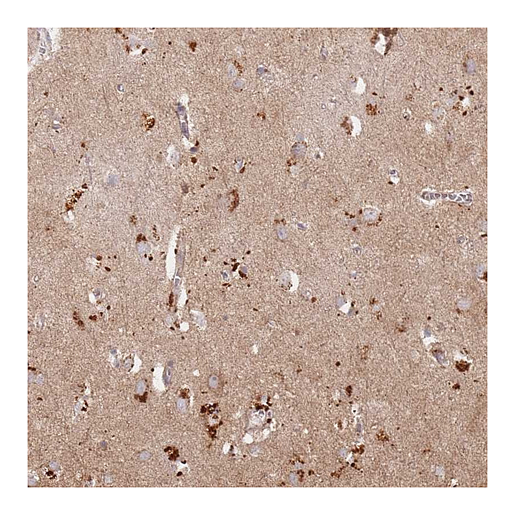 Atlas Antibodies Anti-RIMBP2 Antibody