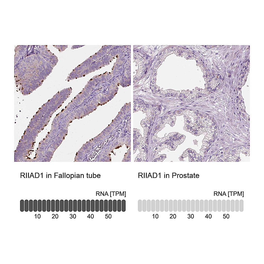 Atlas Antibodies Anti-RIIAD1 Antibody