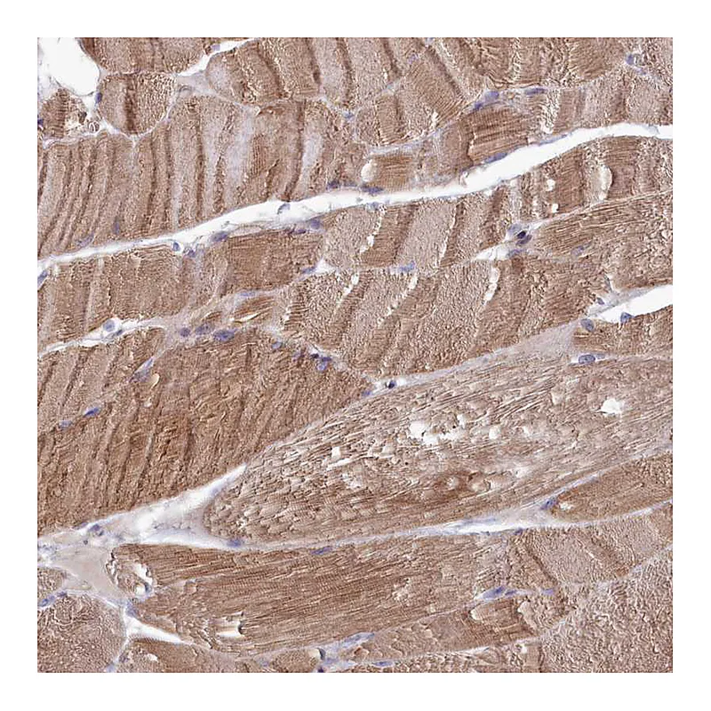 Atlas Antibodies Anti-RILPL1 Antibody