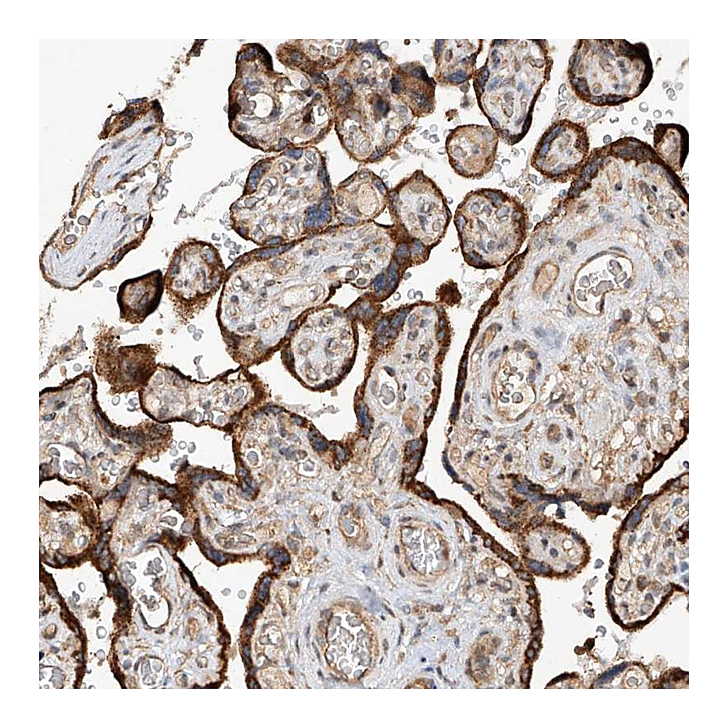 Atlas Antibodies Anti-RILPL2 Antibody