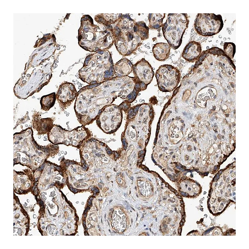 Atlas Antibodies Anti-RILPL2 Antibody