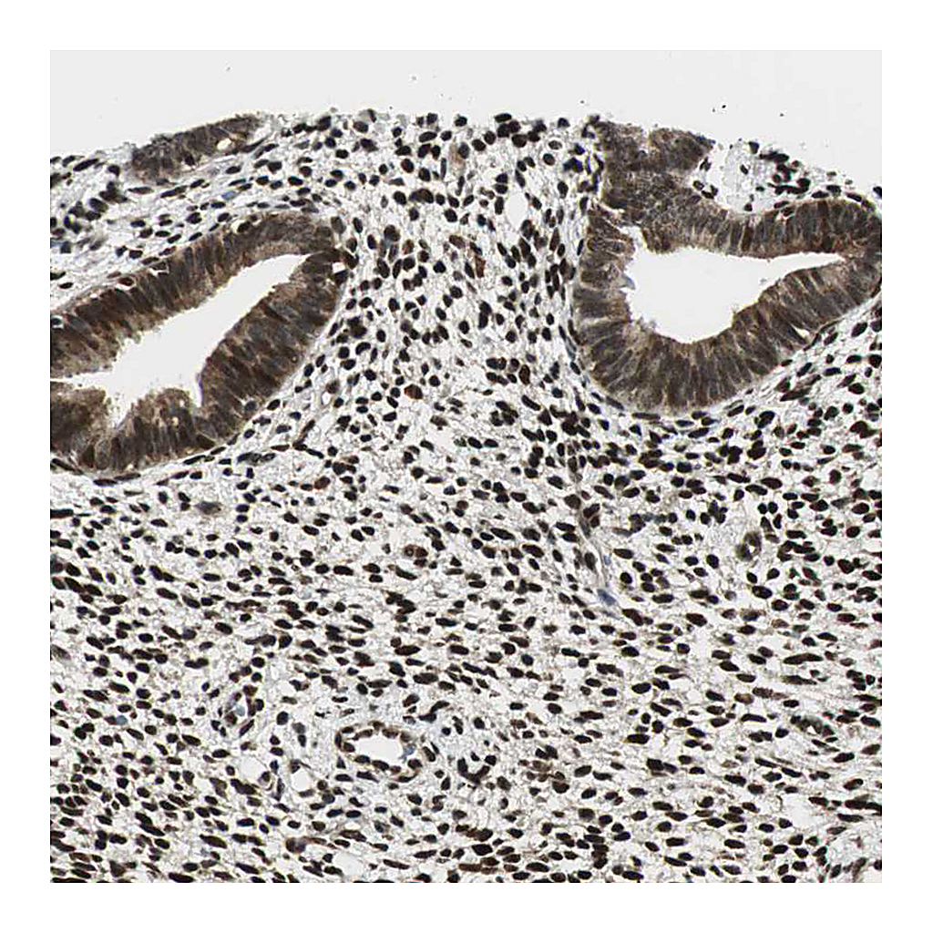 Atlas Antibodies Anti-RING1 Antibody