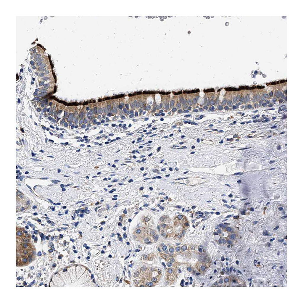 Atlas Antibodies Anti-RINT1 Antibody