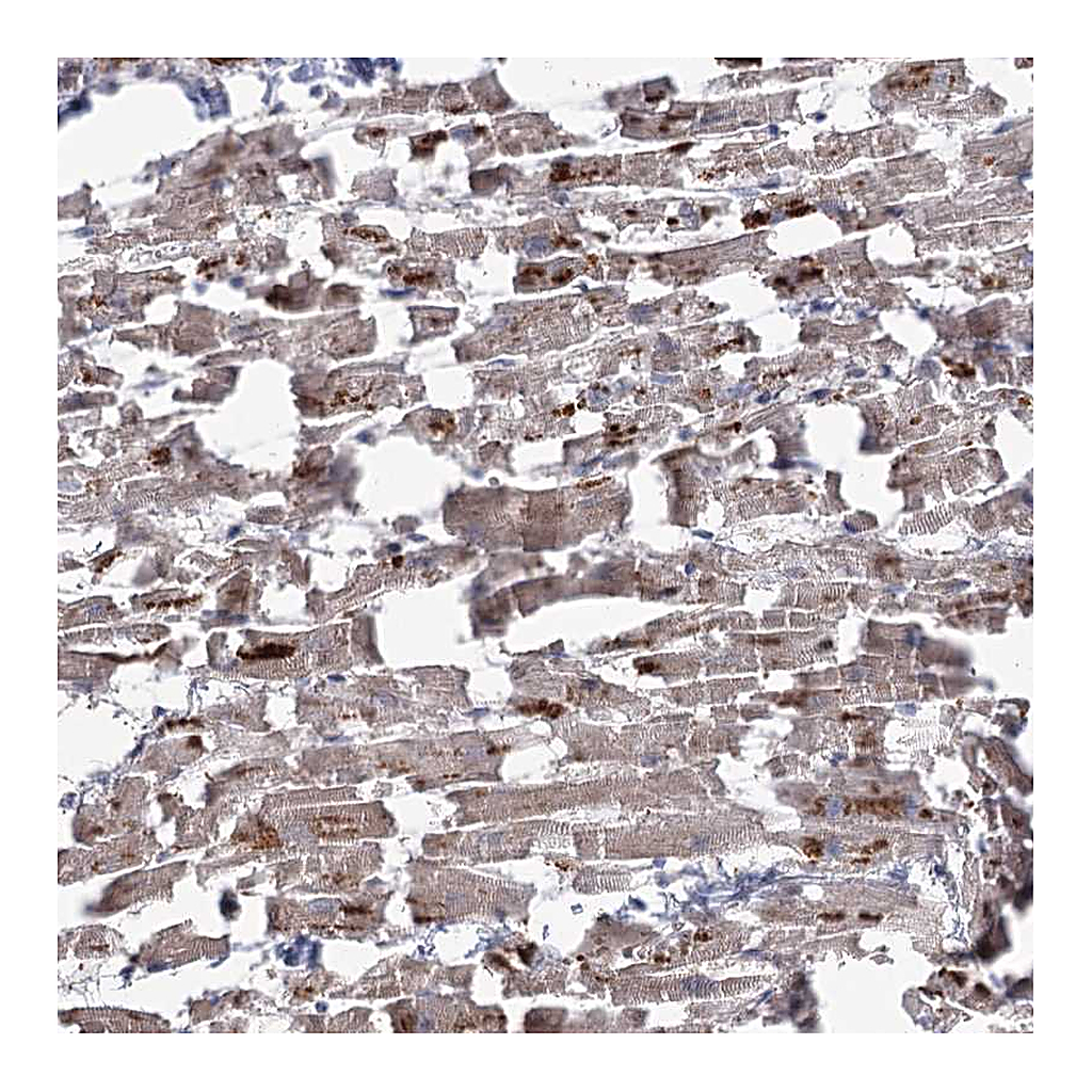 Atlas Antibodies Anti-RIN2 Antibody