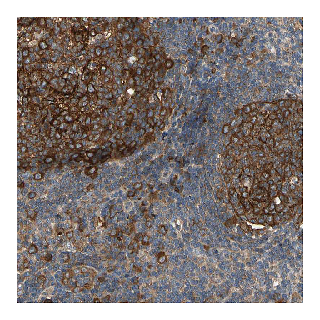 Atlas Antibodies Anti-RIOK2 Antibody