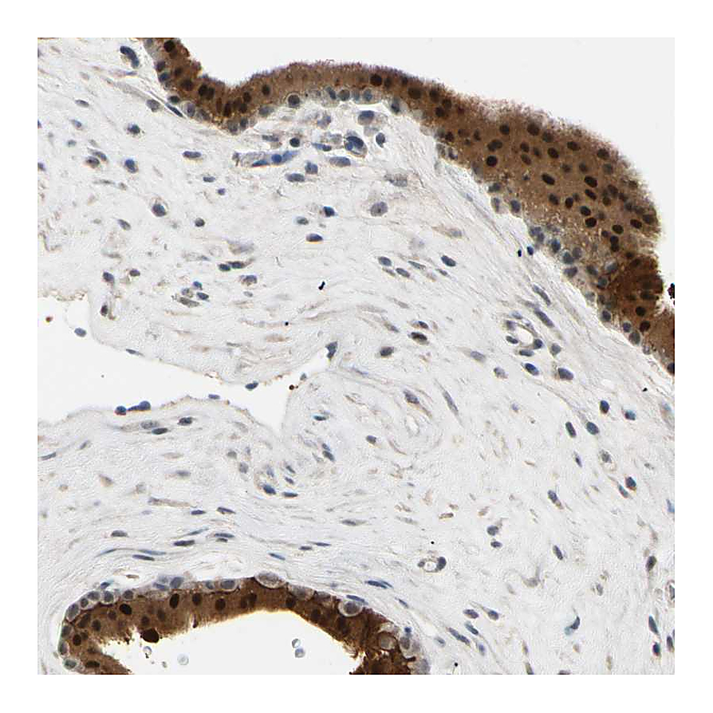 Atlas Antibodies Anti-RIOX2 Antibody