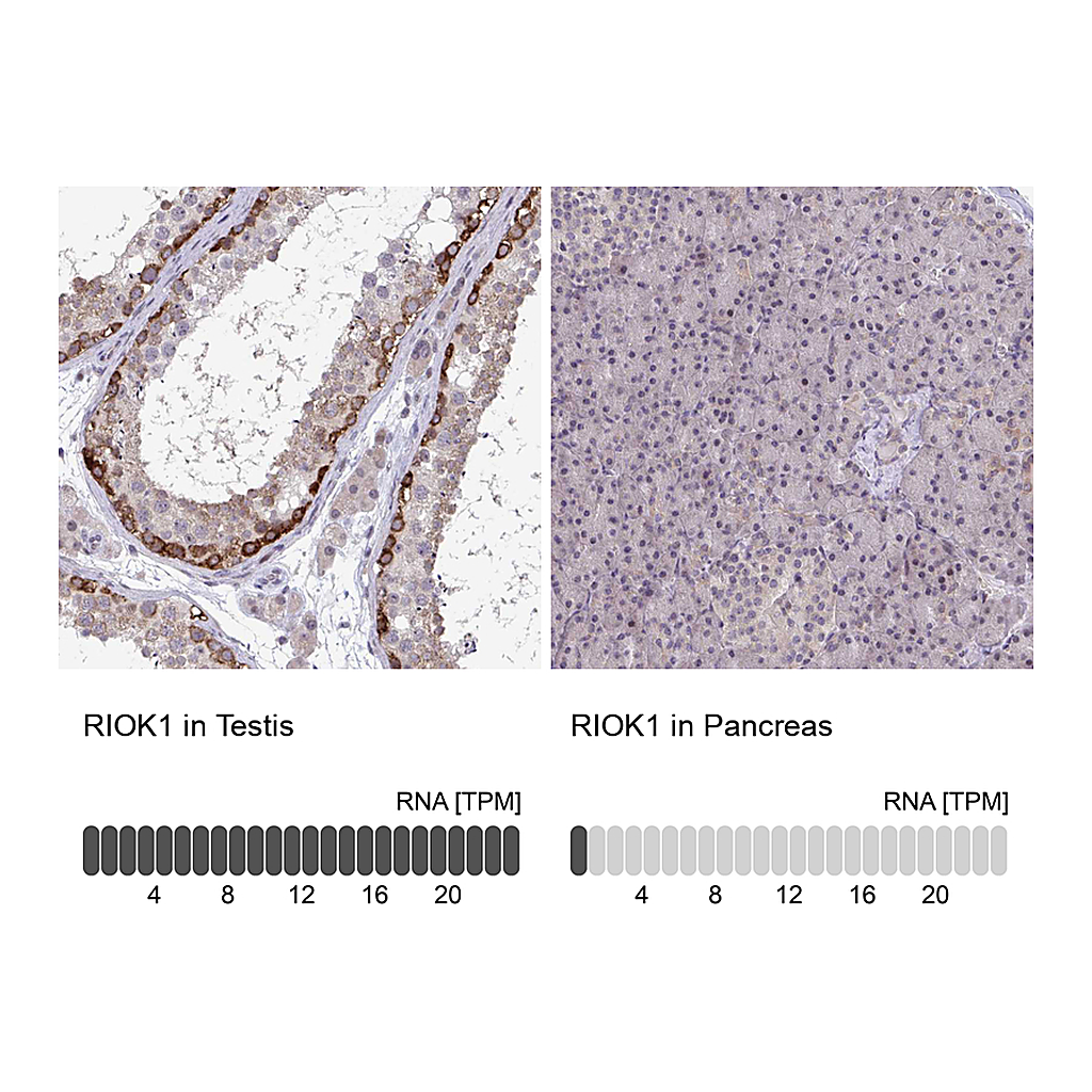 Atlas Antibodies Anti-RIOK1 Antibody