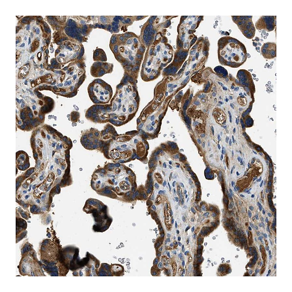Atlas Antibodies Anti-RIPK2 Antibody