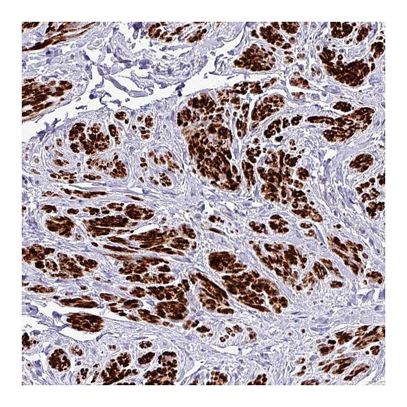 Atlas Antibodies Anti-RIPPLY1 Antibody