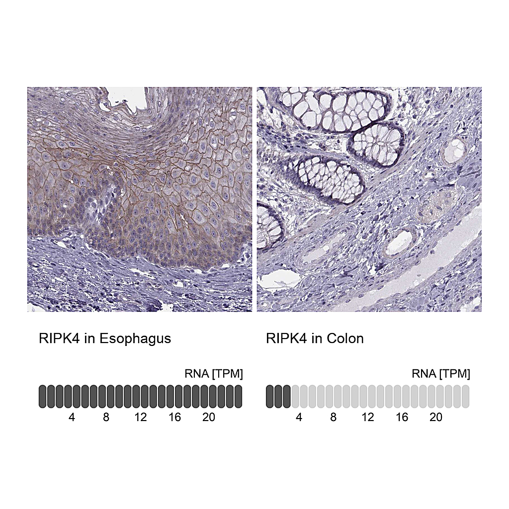 Atlas Antibodies Anti-RIPK4 Antibody