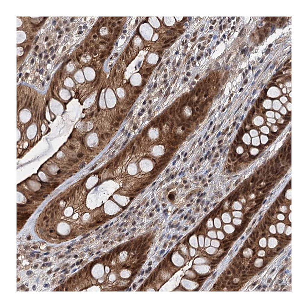 Atlas Antibodies Anti-RITA1 Antibody