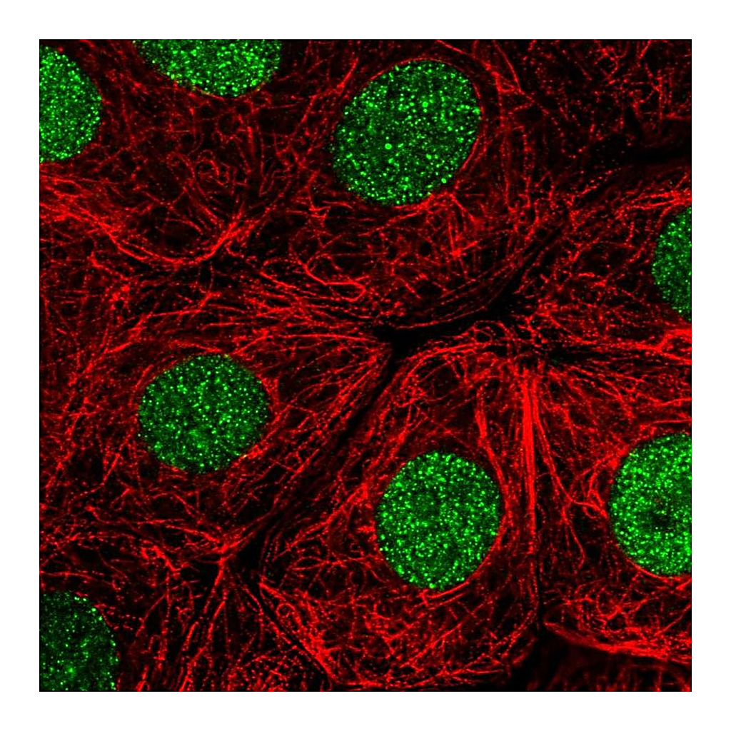 Atlas Antibodies Anti-RITA1 Antibody