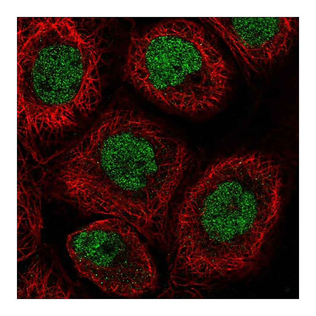 Atlas Antibodies Anti-RLF Antibody