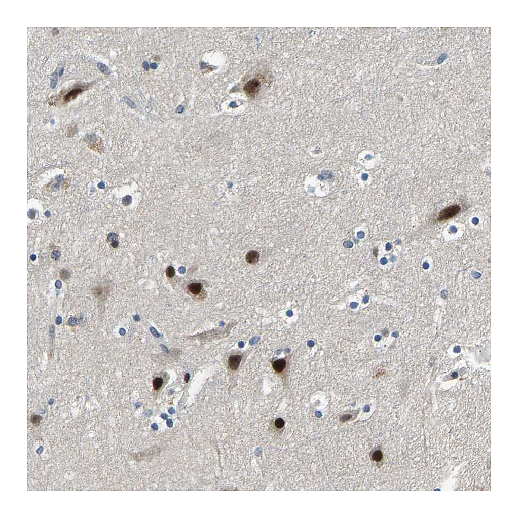 Atlas Antibodies Anti-RLIM Antibody