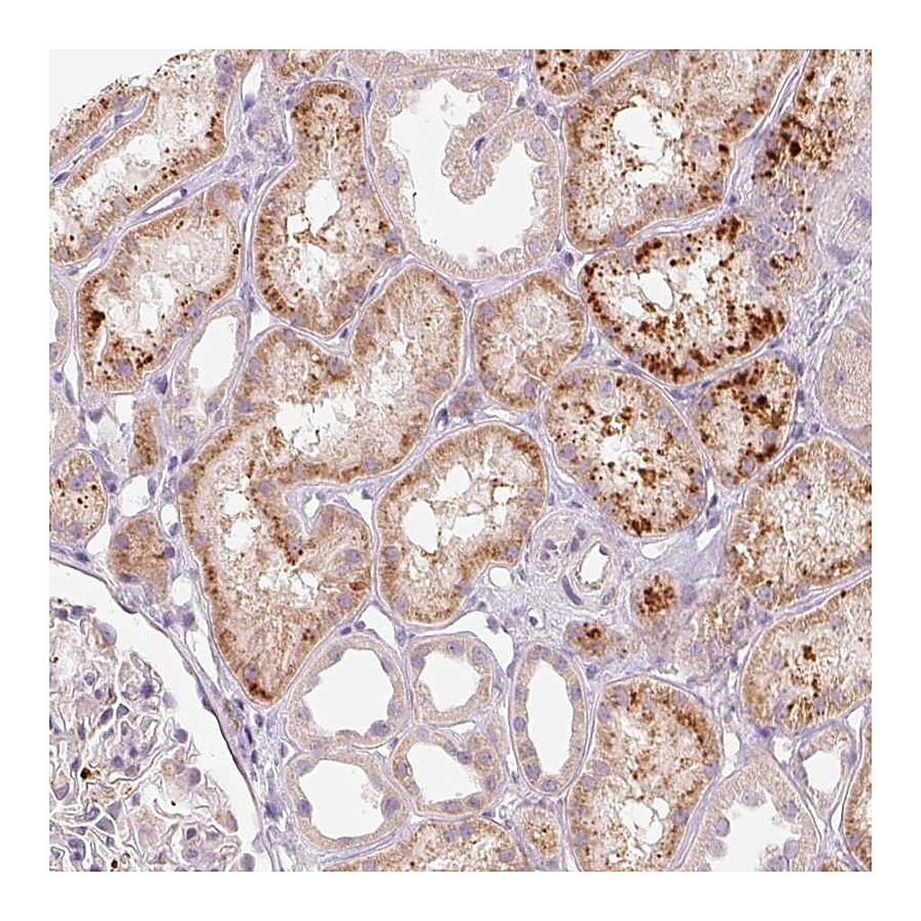 Atlas Antibodies Anti-RMDN2 Antibody