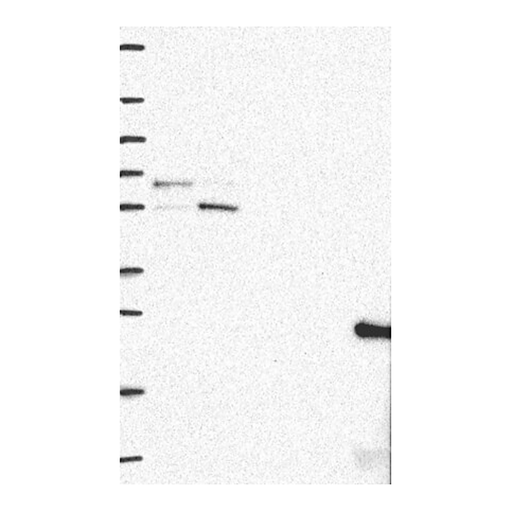 Atlas Antibodies Anti-RMDN3 Antibody