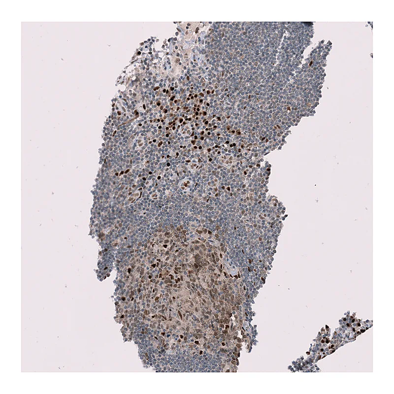 Atlas Antibodies Anti-RMI2 Antibody