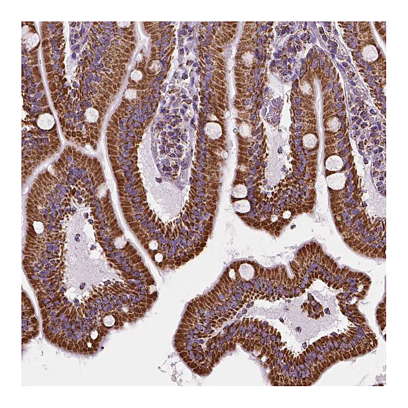 Atlas Antibodies Anti-RMDN3 Antibody