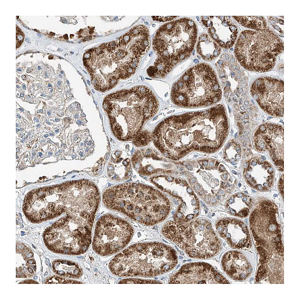 Atlas Antibodies Anti-RMND1 Antibody