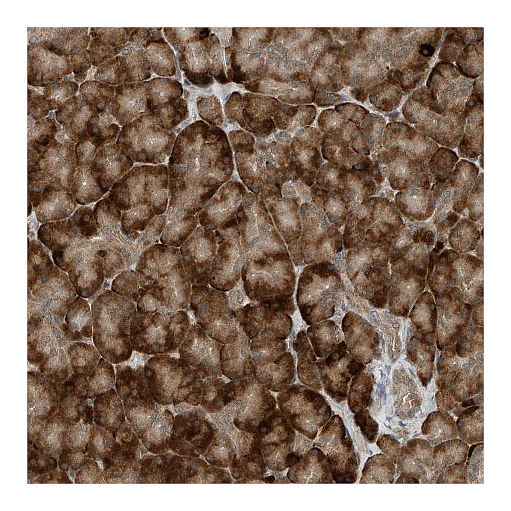 Atlas Antibodies Anti-RMND1 Antibody