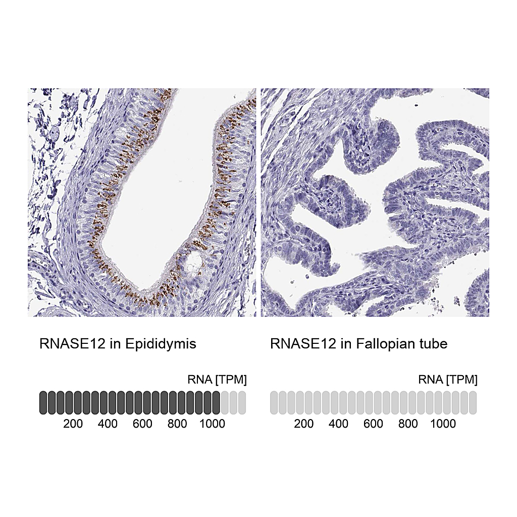 Atlas Antibodies Anti-RNASE12 Antibody