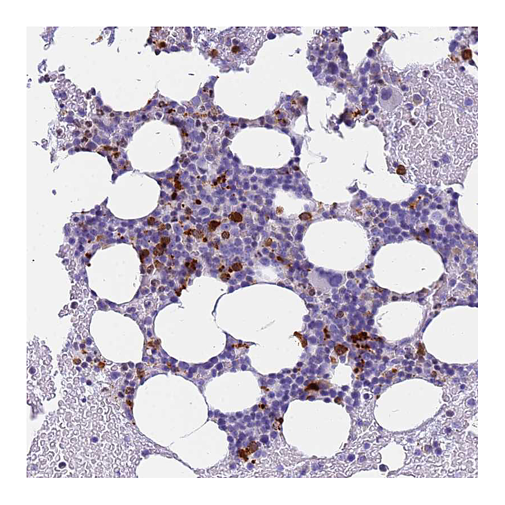 Atlas Antibodies Anti-RNASE2 Antibody