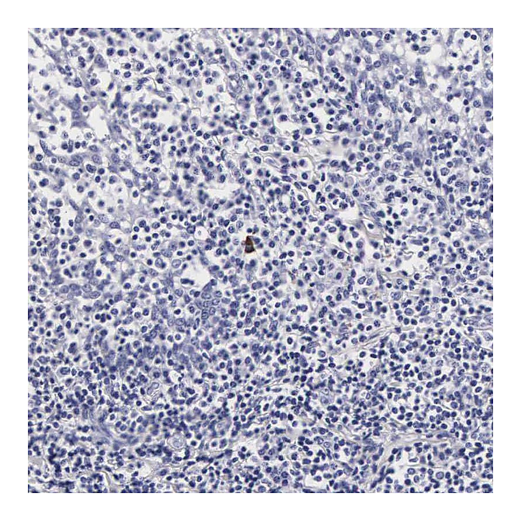 Atlas Antibodies Anti-RNASE6 Antibody