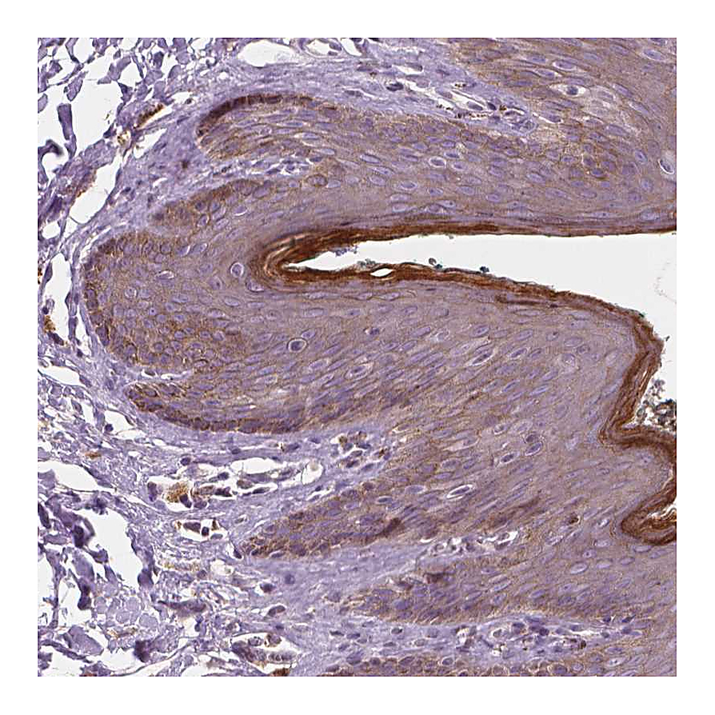 Atlas Antibodies Anti-RNASE7 Antibody