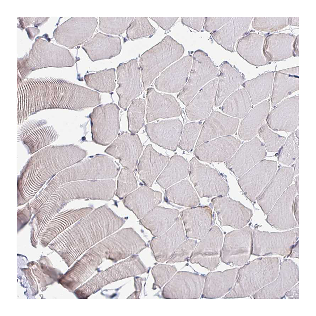 Atlas Antibodies Anti-RNASEH1 Antibody