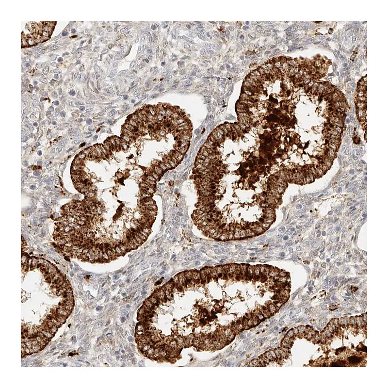 Atlas Antibodies Anti-RNASET2 Antibody