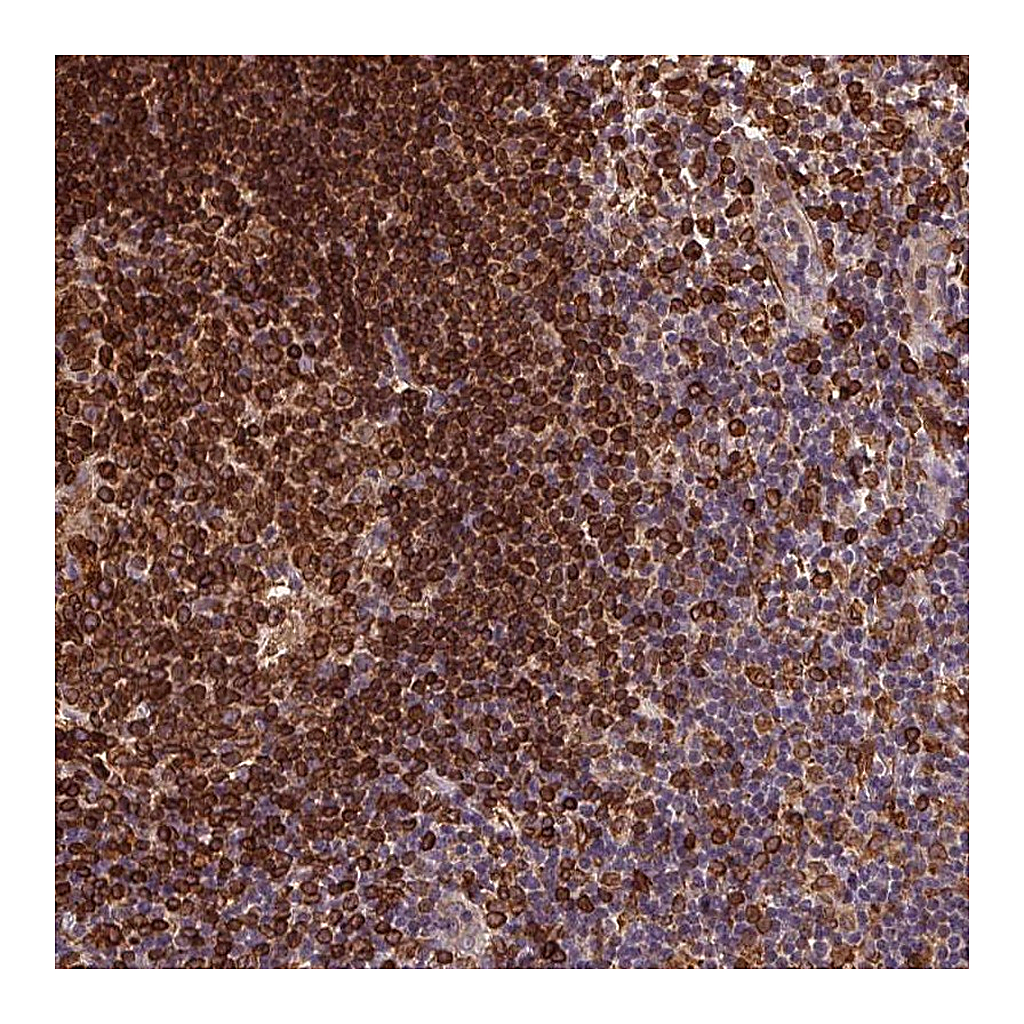 Atlas Antibodies Anti-RNASET2 Antibody