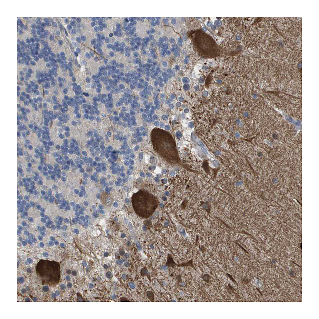 Atlas Antibodies Anti-RNF112 Antibody