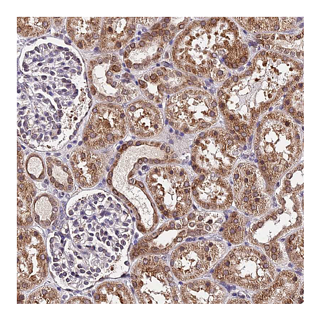 Atlas Antibodies Anti-RNF121 Antibody