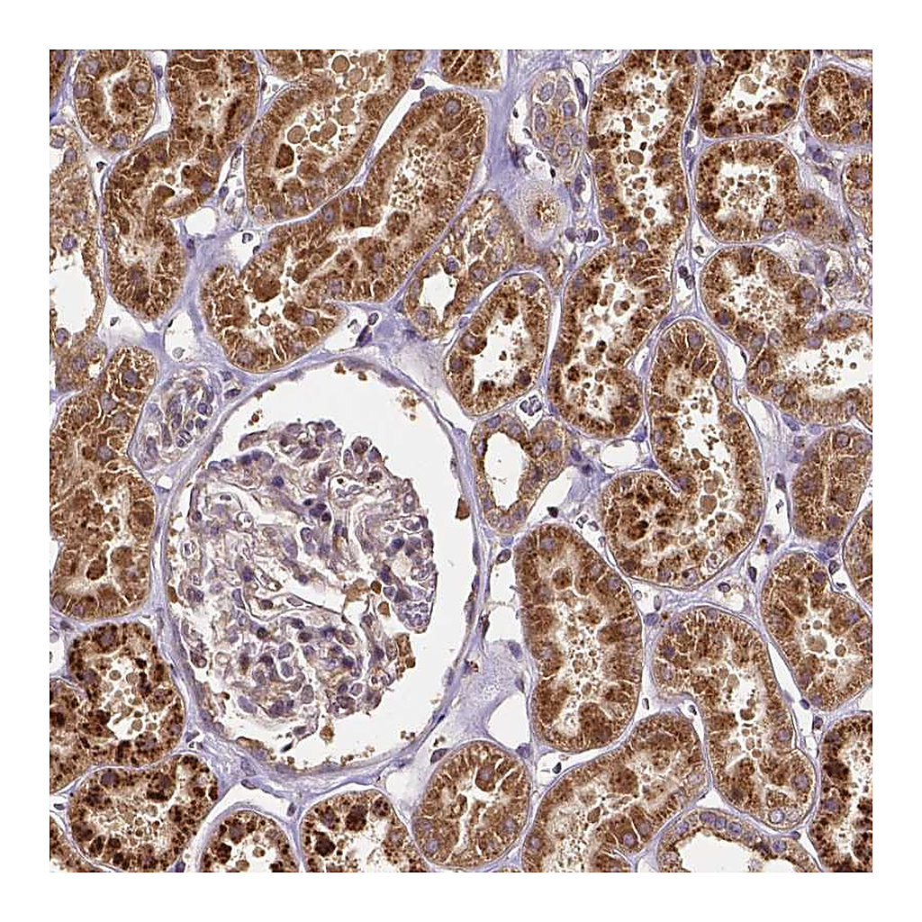 Atlas Antibodies Anti-RNF123 Antibody