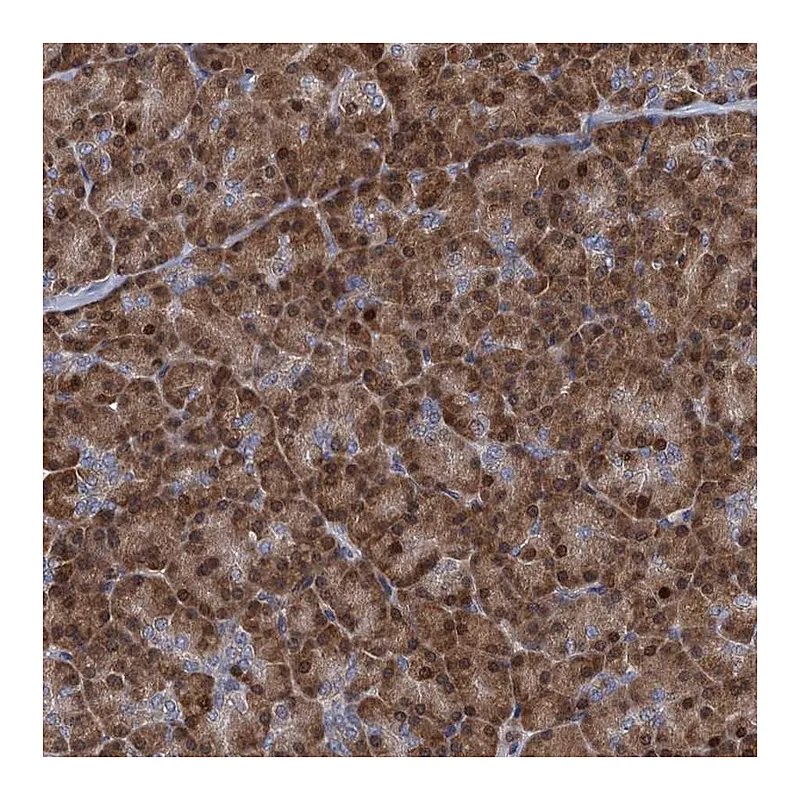 Atlas Antibodies Anti-RNF125 Antibody