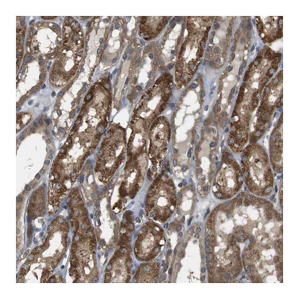 Atlas Antibodies Anti-RNF130 Antibody