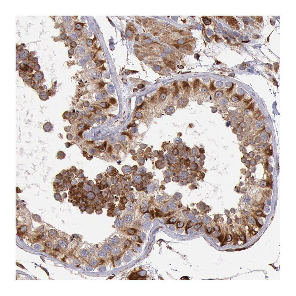 Atlas Antibodies Anti-RNF139 Antibody