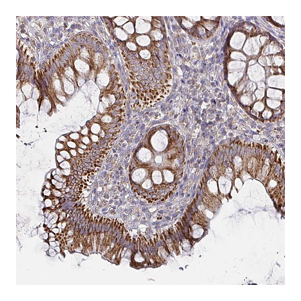 Atlas Antibodies Anti-RNF144B Antibody
